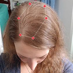 Alyssa's hair growth result