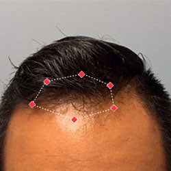 Sammy's hair growth result