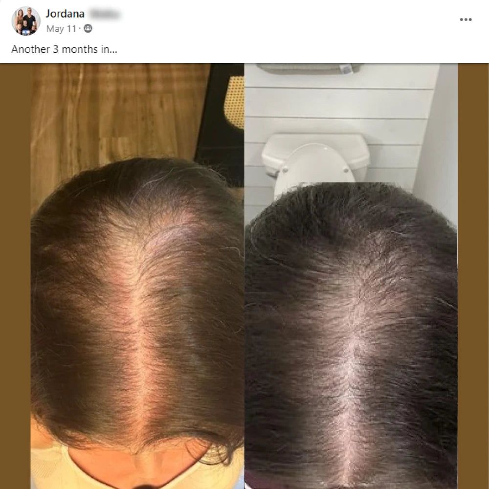 Jordana's before and after hair growth story