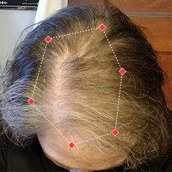Amanda's hair growth result