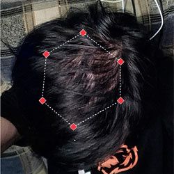 Emma's hair growth result