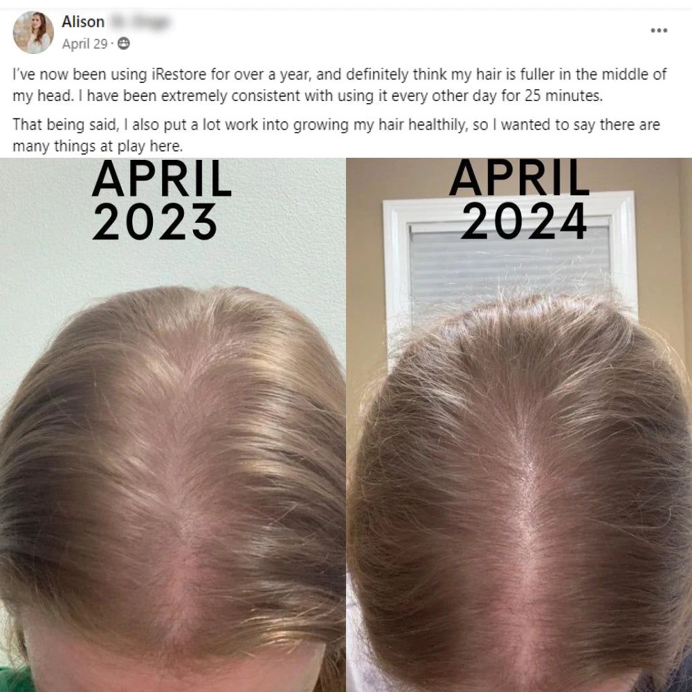 Alison's before and after hair growth story