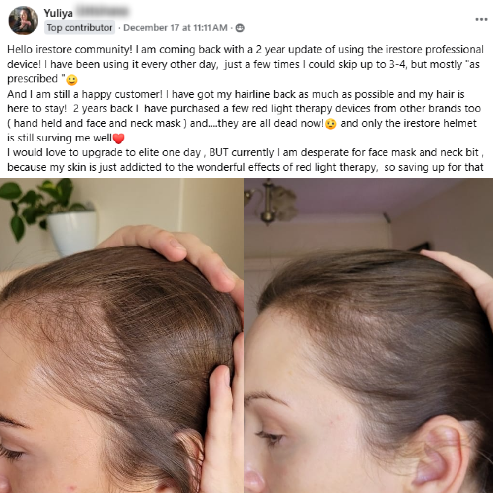 Yuliya's before and after hair growth story